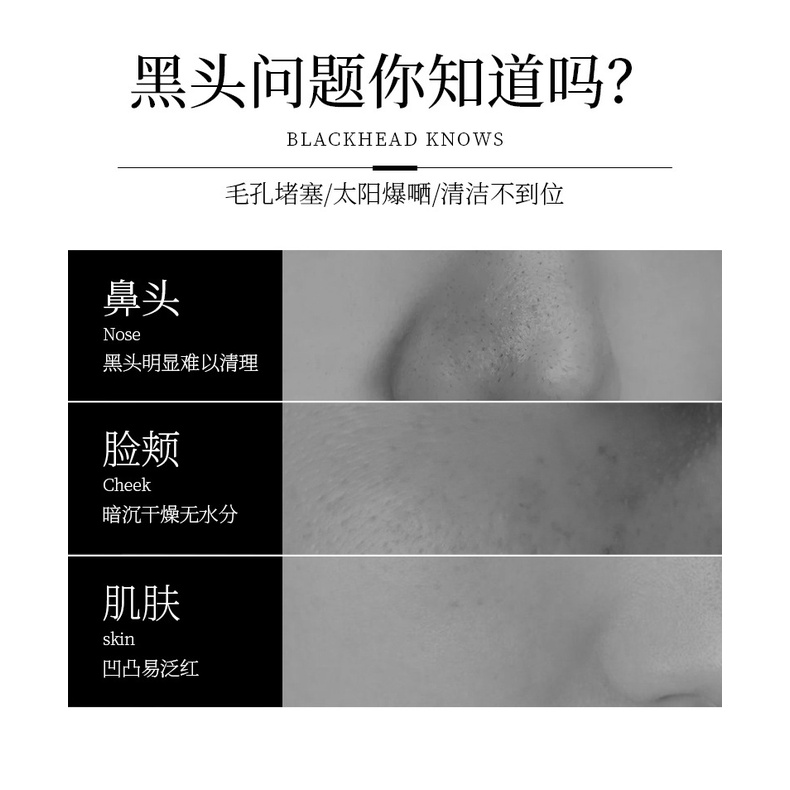 Mặt nạ VEZE dạng Gel Lột Mụn Đầu Đen than hoạt tính