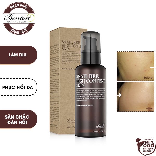 Nước Hoa Hồng Phục Hồi, Làm Dịu Da Benton Snail Bee High Content Skin 150ml