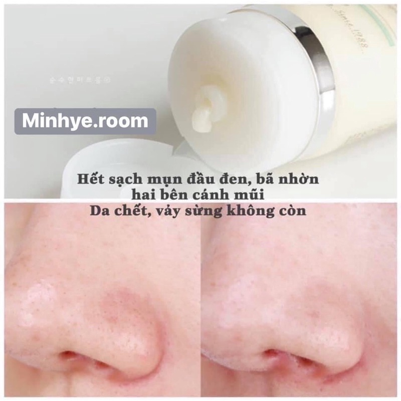 Tẩy Tế Bào Chết Mặt Ample:n Enzim Lên Men Từ Bha Thiên Nhiên Bí Đỏ Sạch Hoàn Toàn Mụn Cám Đầu Đen Da Chết