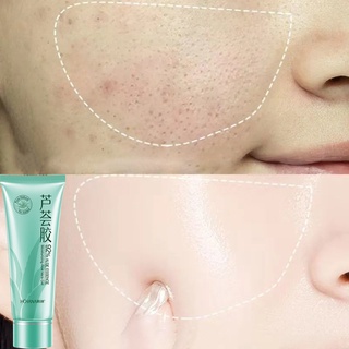 Gel Lô Hội cấp ẩm dưỡng da cấp ẩm phục hồi da dịu dàng và mượt