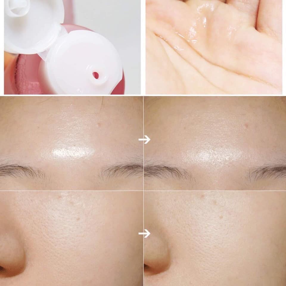 🌳Toner "quốc dân" hot hit.... | BigBuy360 - bigbuy360.vn