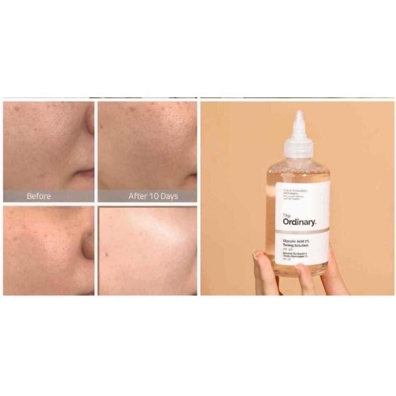 Nước hoa hồng tẩy tế bào da chết Toner AHA The Ordinary Glycolic Acid 7% Toning 240ml fullsize fullbox