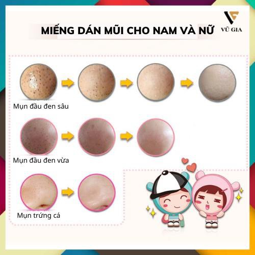 Miếng Lột Mụn Đầu Đen, Miếng Dán Lột Mụn Đầu Đen Bioaqua Với 3 Bước Cơ Bản Lột Sạch Mụn Một Cách Dễ Dàng Hiệu Quả