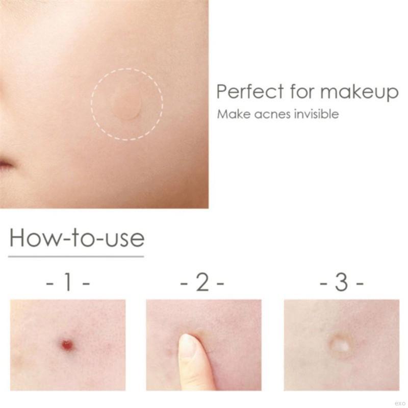 24 Pcs/Set Pimple Master Patch Painless Pimple Moisturizing Skin Facial Care Tools