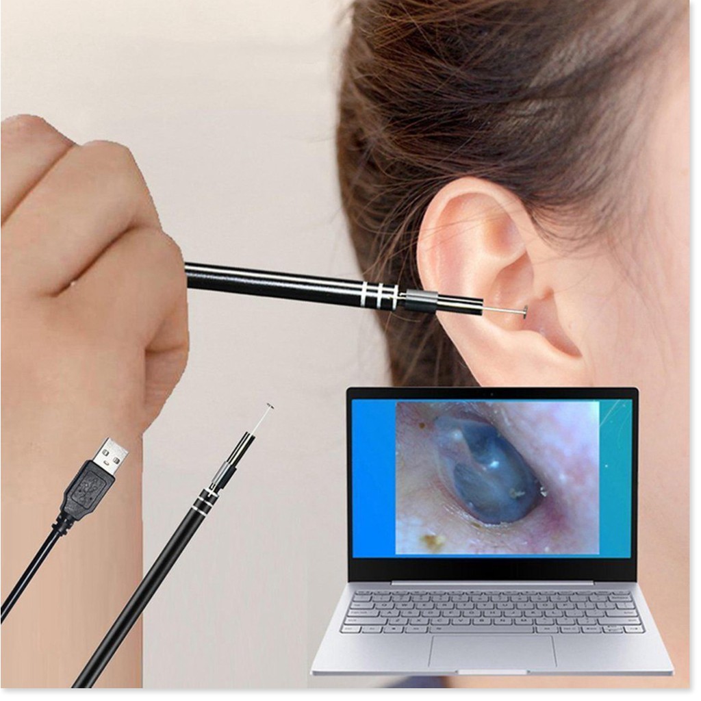 Dụng Cụ Ngoáy Tai Cho Bé ✔️Chính Hãng✔️ 3 trong 1 có đèn LED, Nội Soi Tai Mũi Họng, Có Kết Nối Với Điện Thoại, Máy Tính