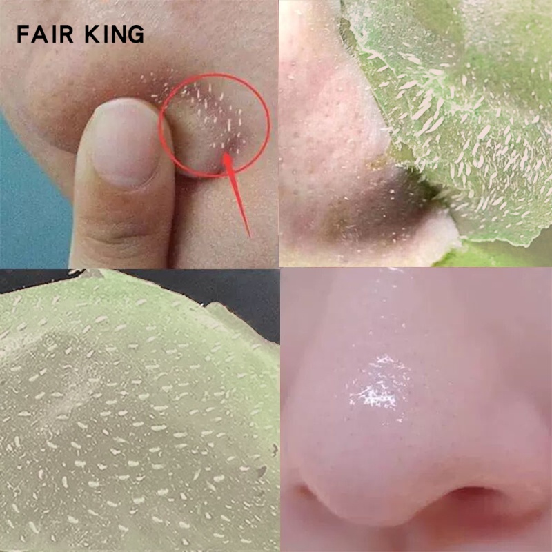 Kem dưỡng da mặt MEIYANQIONG FAIR KING chiết xuất trà xanh kiềm dầu loại bỏ tàn nhang và làm trắng da