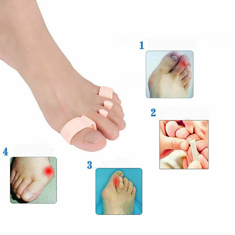 Cặp Dụng Cụ Tách Ngón Chân Hỗ Trợ Điều Chỉnh Và Tách Ngón Chân Bị Biến Dạng