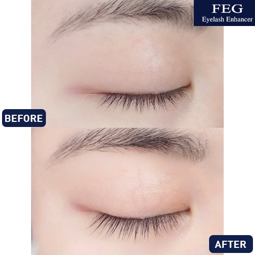 [CHÍNH-HÃNG] Dưỡng mi xanh FEG (FEG eyelash enhancer) Dưỡng mi dài dày cong với chiết xuất tự nhiên_3ml | BigBuy360 - bigbuy360.vn