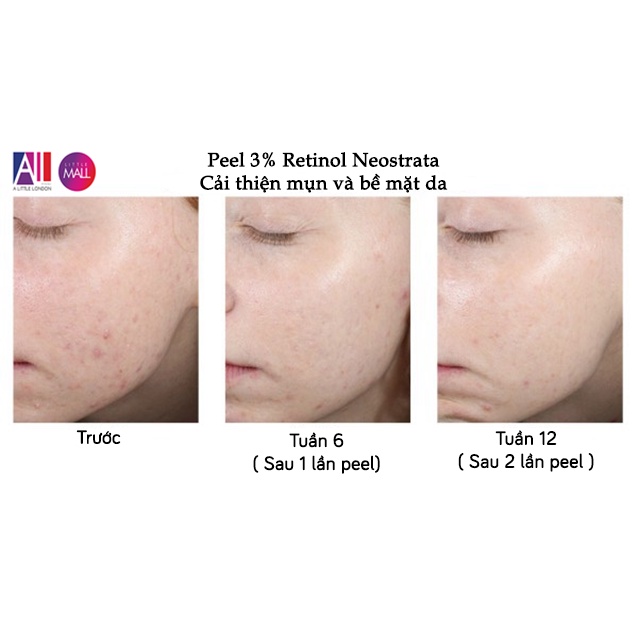 Dung dịch peel sáng da, giảm nhăn Neostrata prosystem 3% retinol peel 1.5ml