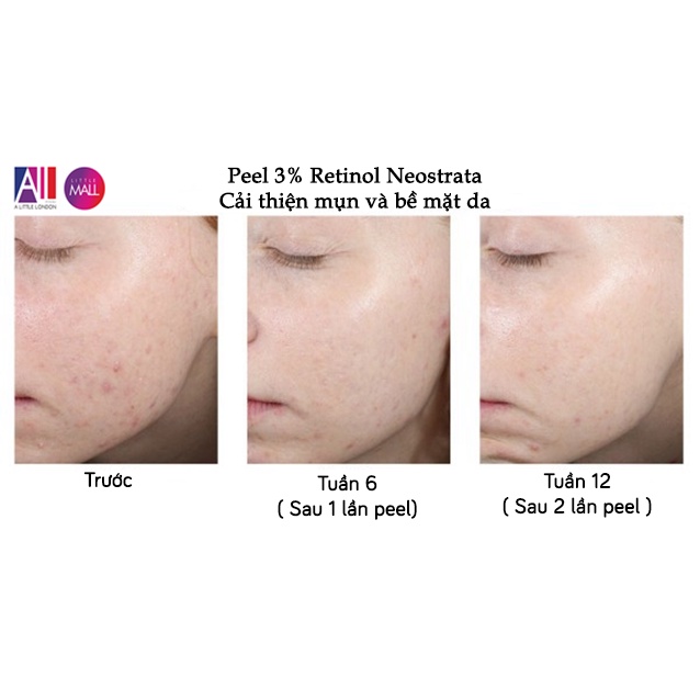 Dung dịch peel sáng da, giảm nhăn Neostrata prosystem 3% retinol peel TẶNG tinh chất phục hồi Martiderm (Nhập khẩu)