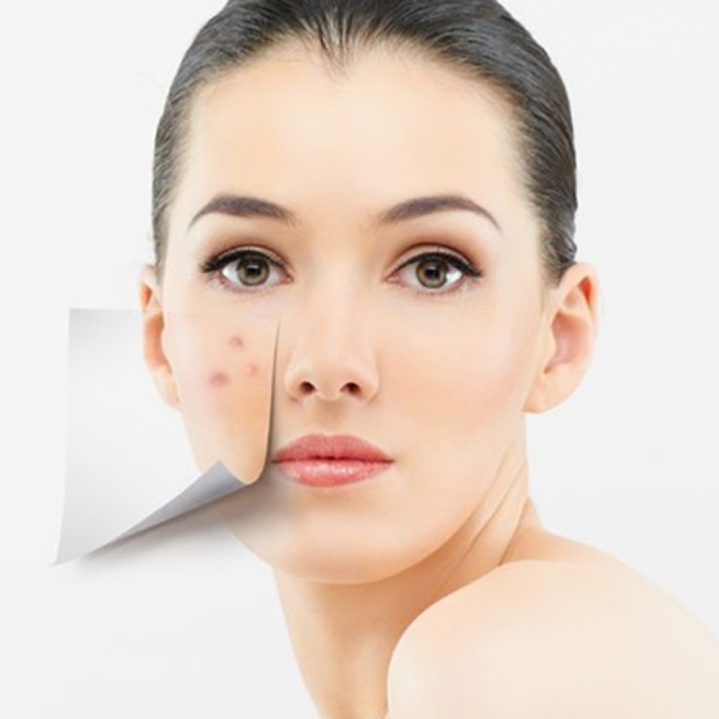 Dung Dịch Tạo Bọt Giúp Ngừa Mụn Acnes Foaming Wash 150ml