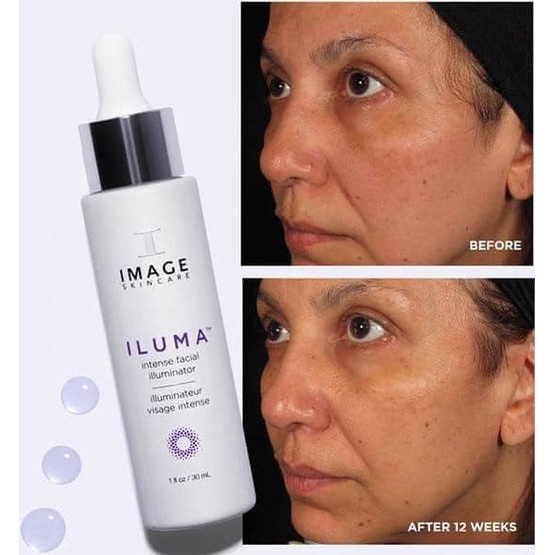Serum sáng da, mờ thâm nám Image Skincare Iluma Intense Facial Illuminator 7,4ml