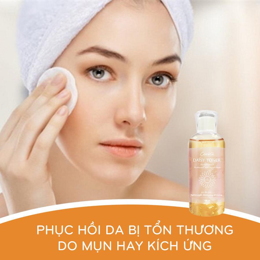 Toner hoa cúc Cénota Daisy, toner hoa cúc ngừa mụn, cân bằng độ ẩm mã - C16 | BigBuy360 - bigbuy360.vn
