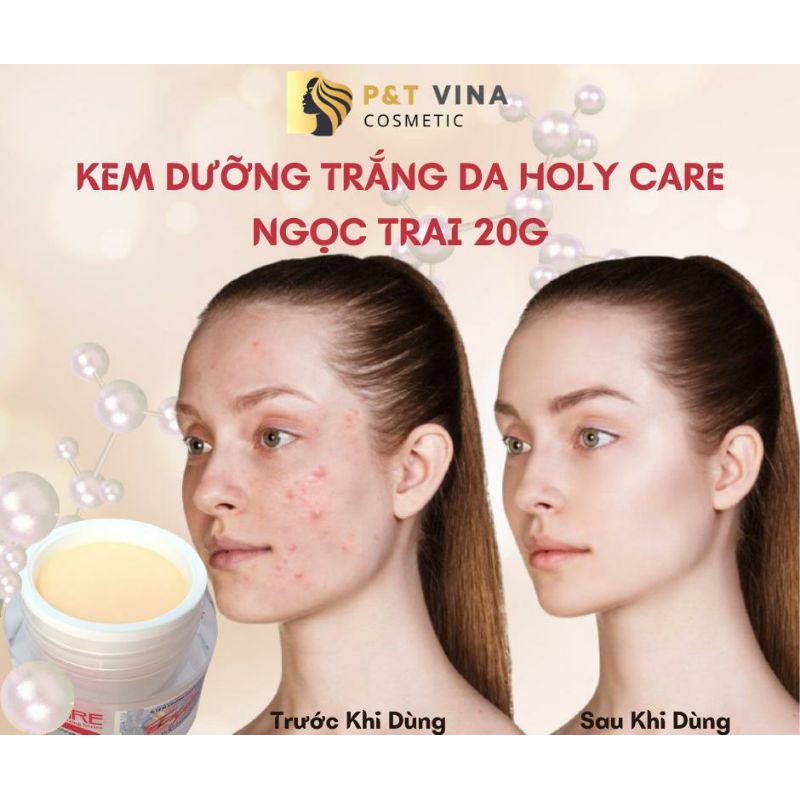 [Chính Hãng] Kem Holy Care Dưỡng Trắng Da Ngừa Mụn Mờ Nám Tinh Chất Ngọc Trai Collagen 20G