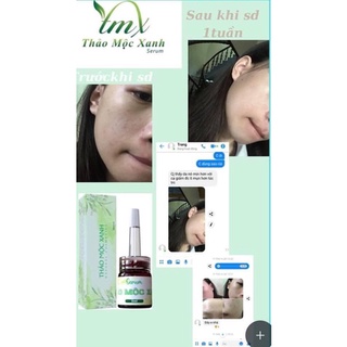 [Sẵn Hàng] Thảo Mộc xanh 3 lọ