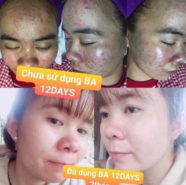 Mặt nạ ngủ yến tươi collagen