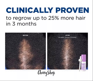 [Hàng USA]Mọc tóc cho nữ Women's Rogaine 2% Minoxidil Solution (dạng dung dịch)