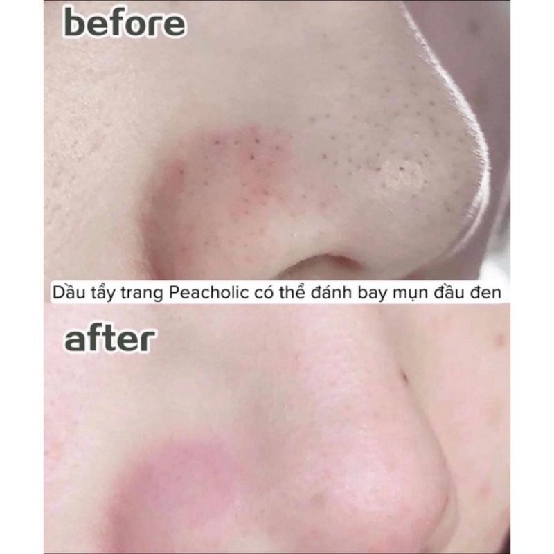Dầu tẩy trang Peacholic