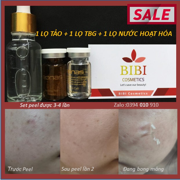 [Chính Hãng + File hướng dẫn] 1 SET Vi Kim Tảo Biển &amp; TBG Ronas Resting Peel