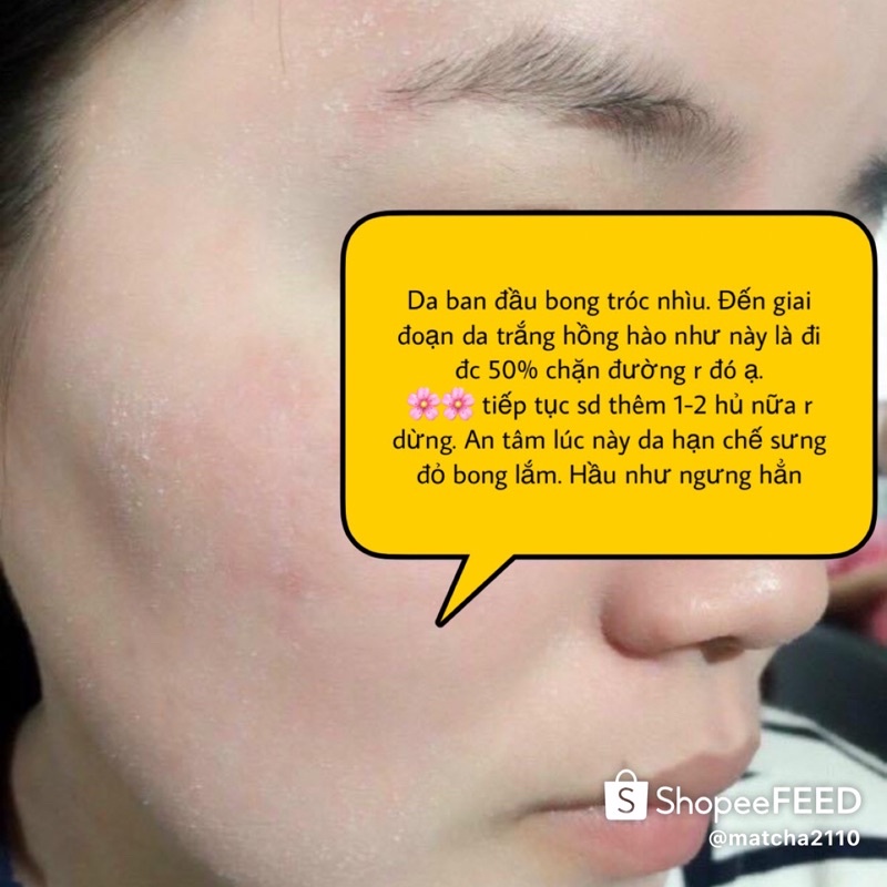kem tái tạo babyface handmade