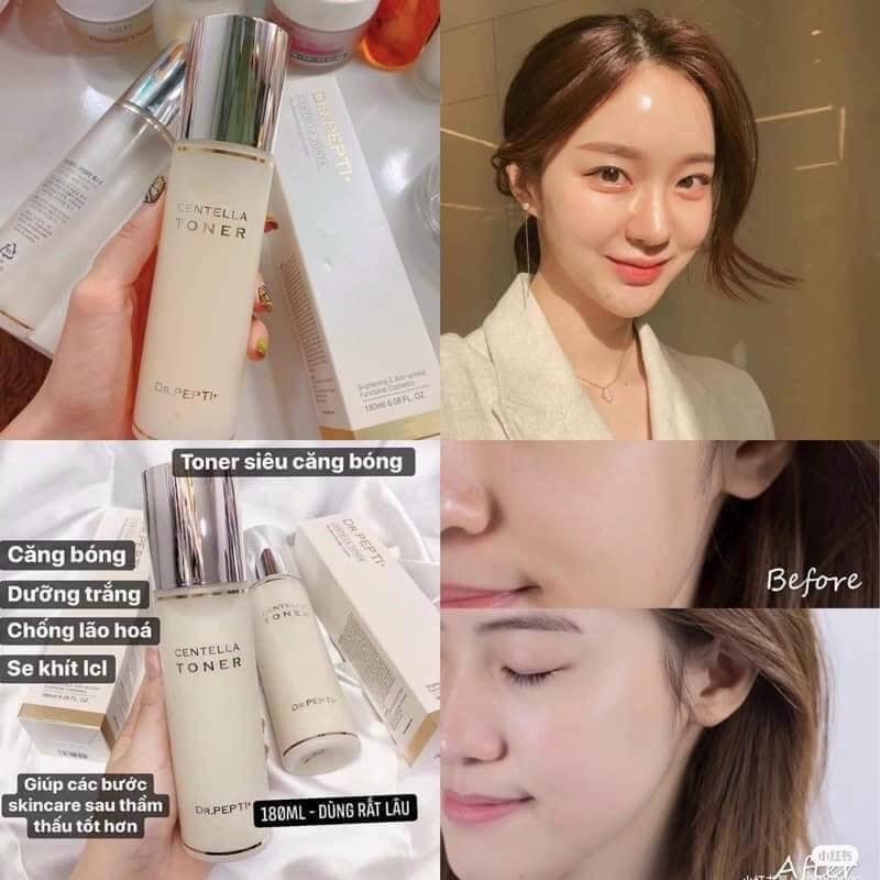 Nước hoa hồng dr. pepti centella 180ml – hàn quốc Hàng Hiệu
