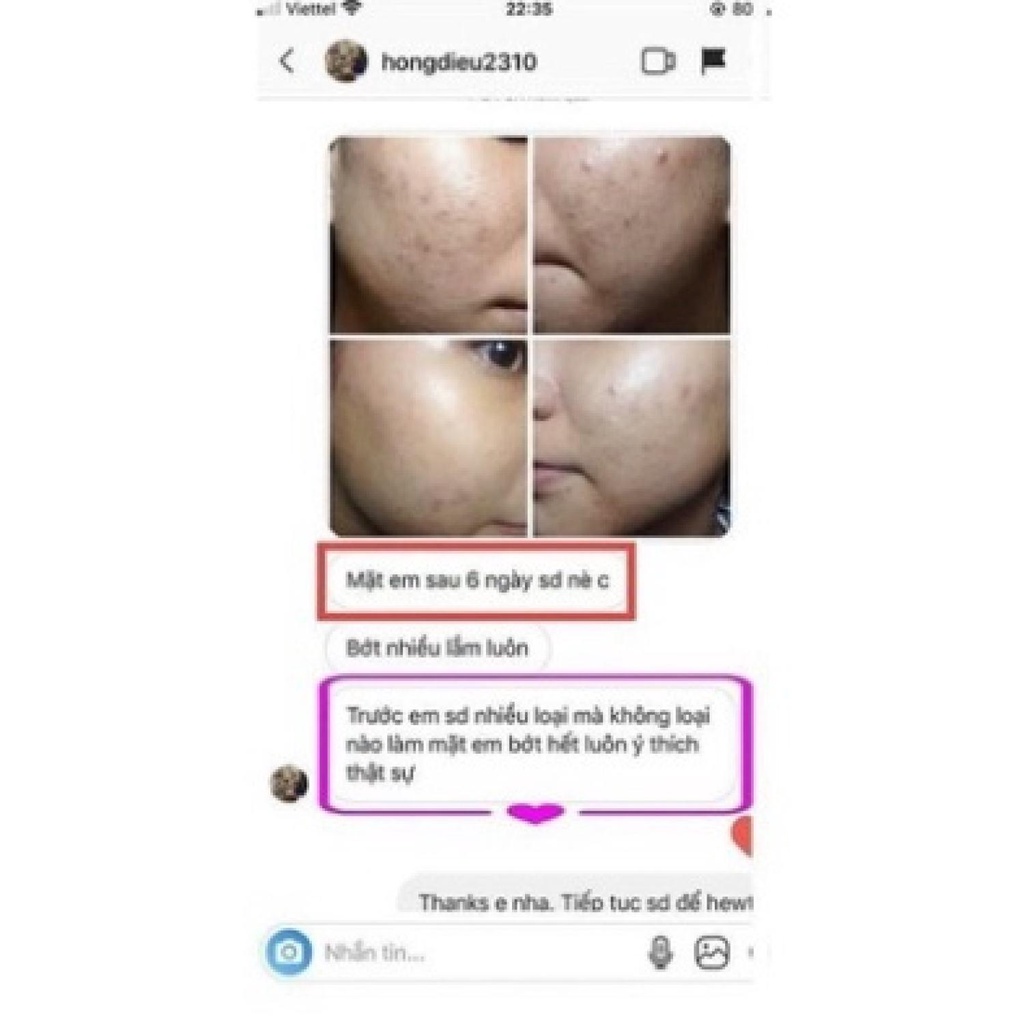 Kem khô đầu mụn đẩy nhân mụn, mờ thâm +Dr.Lee Reduce Acne Cream - cam kết thay đổi sau một liệunh