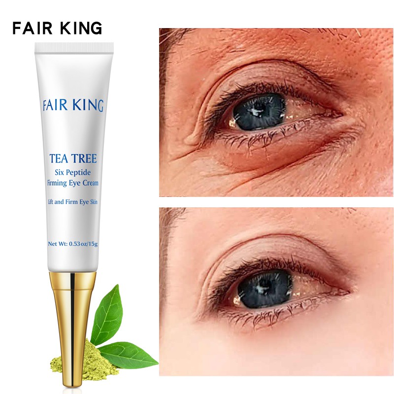 Kem dưỡng da mắt FAIR KING Six Peptide chống nếp nhăn lão hóa loại bỏ quầng thâm bọng mắt dưỡng ẩm làm trắng da 15g
