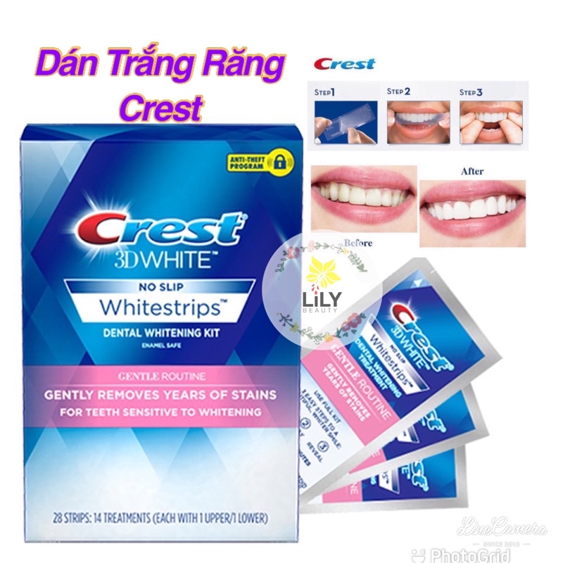 (Bill_sẵn) Miếng dán trắng răng crest Mỹ