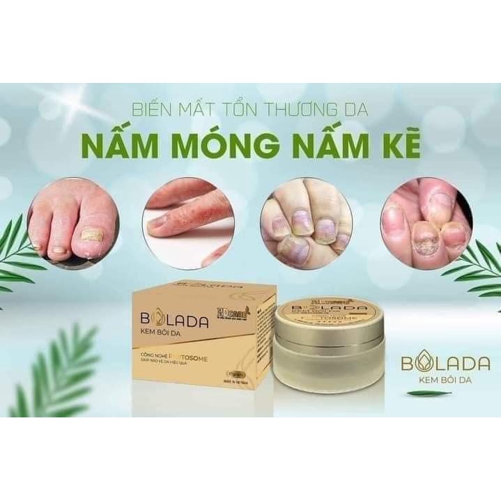 Kem bôi Bolada 17g BDcare - Giúp làm giảm mẩn ngứa, chàm sữa, làm mềm mịn da