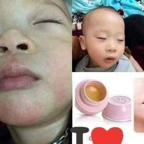 SÁP ONG DƯỠNG ĐA CÔNG DỤNG-TENDE.15ML | BigBuy360 - bigbuy360.vn