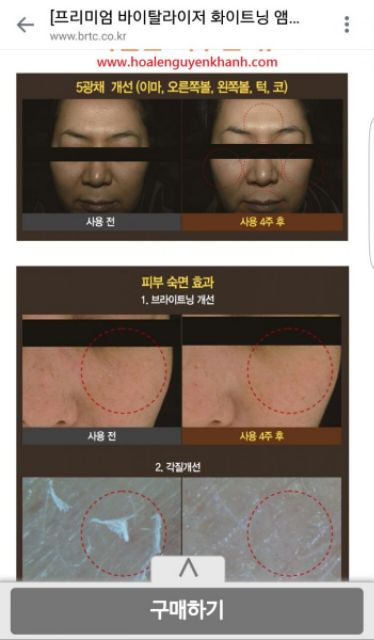 KEM DƯỠNG TRẮNG CHUYÊN ngừa NÁM BRTC PREMIUM WHITENING AMPOULE PACK 80g | BigBuy360 - bigbuy360.vn