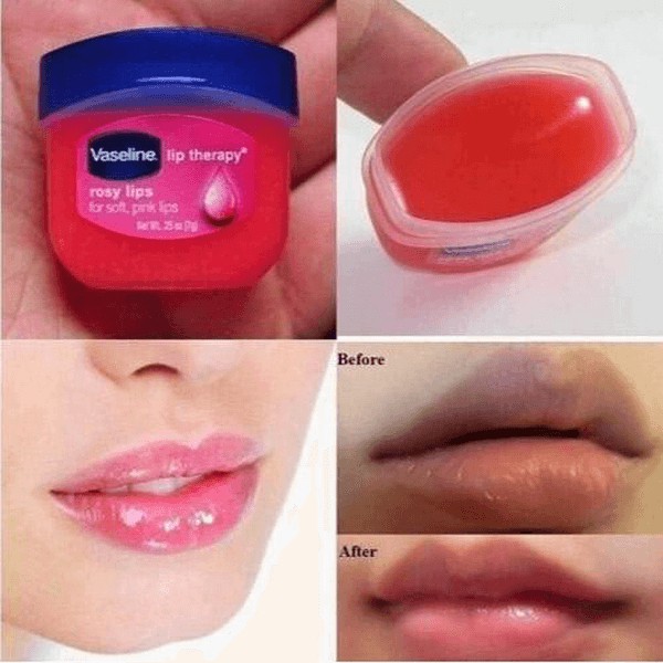 Sáp Dưỡng Môi Vaseline Lip Therapy 7g