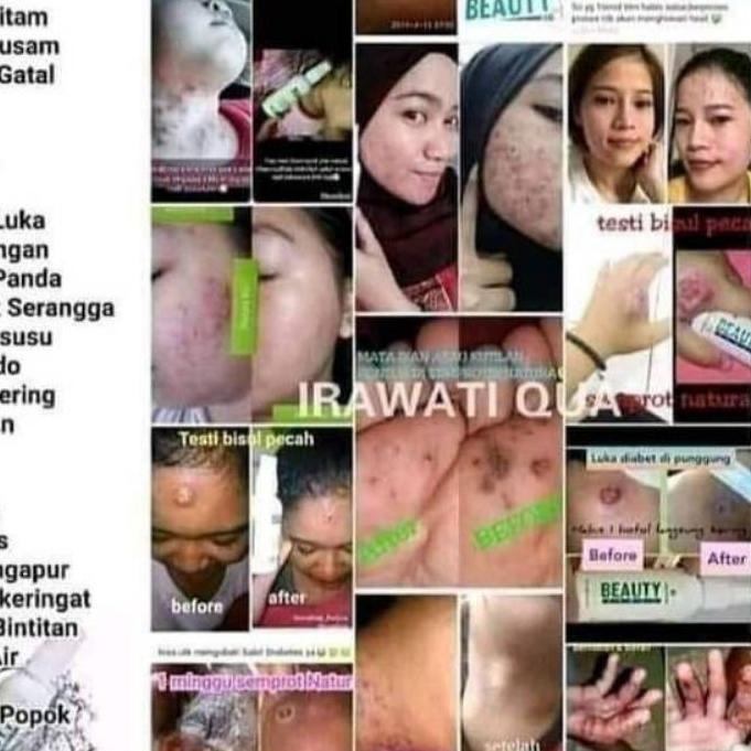 L4ngsung. Gửi⭐! Xịt Làm Đẹp Natura 100% Nguyên Bản (UK70), | BigBuy360 - bigbuy360.vn