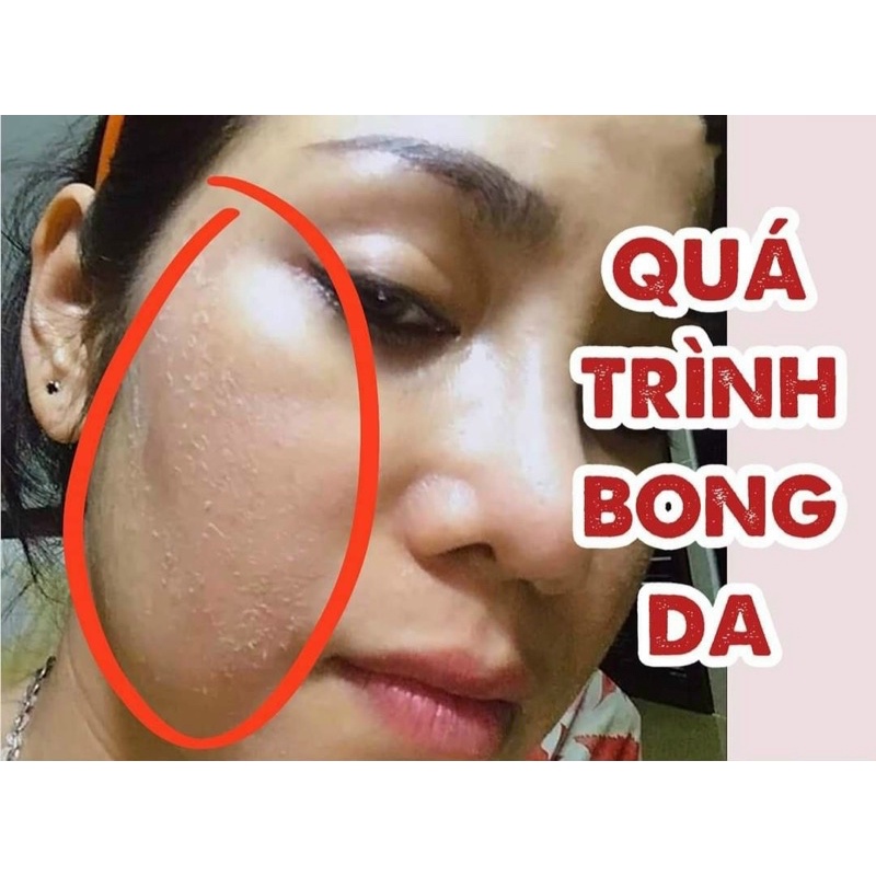 SỈ 1 lít TINH CHẤT KO SƯNG - Handmade