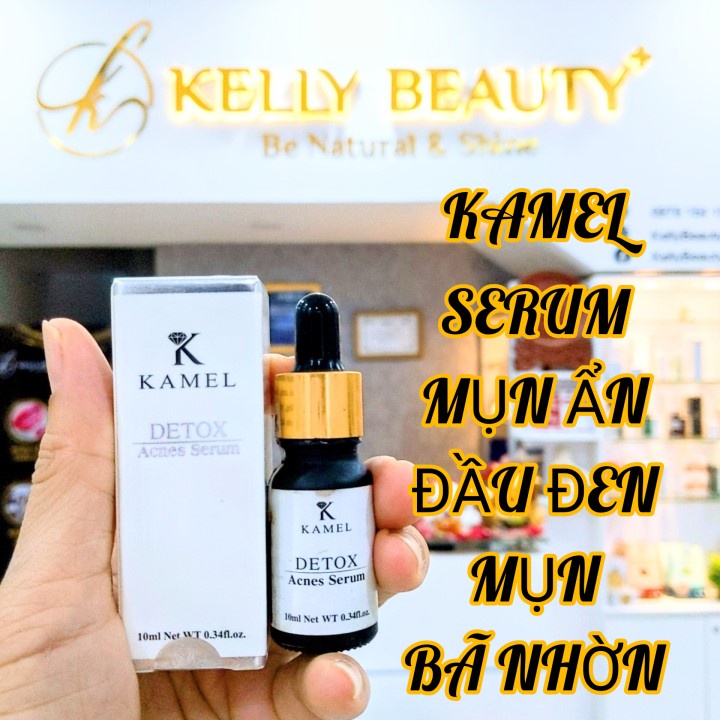 Serum Mụn Detox Acnes KARMEL 10ml – Giải Quyết Mụn Ẩn, Mụn Đầu Đen, Thu Nhỏ Lỗ Chân Lông | KELLY BEAUTY