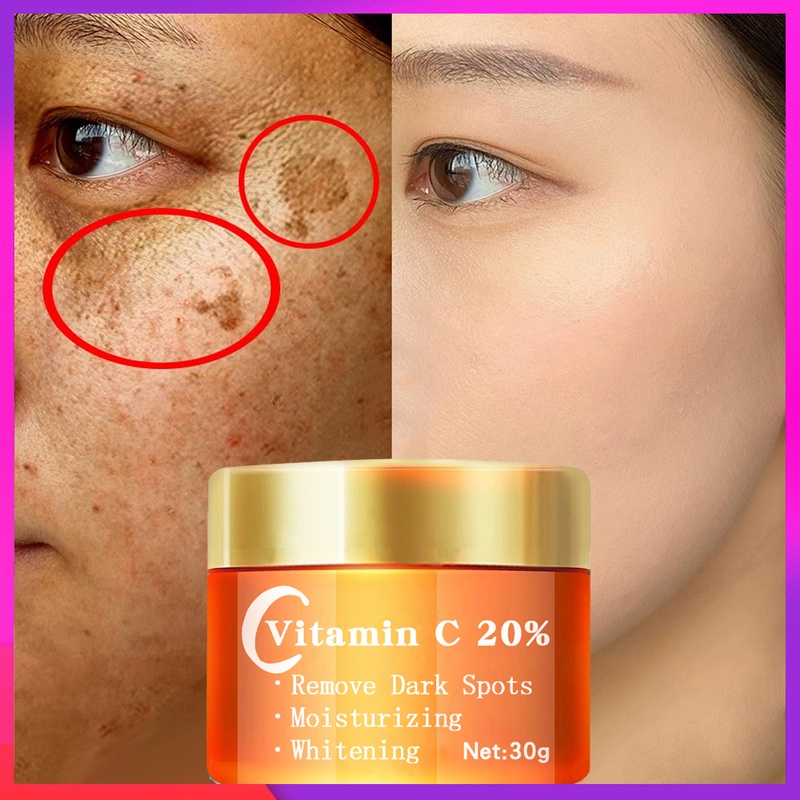 Kem vitamin c dưỡng trắng xóa đốm nâu làm sáng da mặt chữa tàn nhang