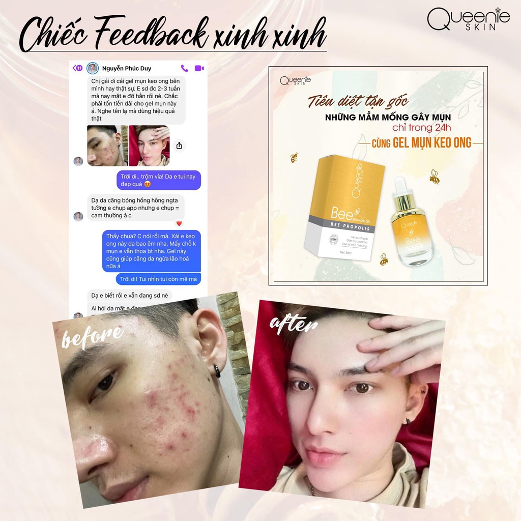 [FreeShip + Tặng Quà] Gel Mụn Keo Ong Queenie Skin Date Mới Nhất - Gel Mụn Queenie Skin Date 2023