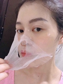 Mặt nạ nhau thai cừu