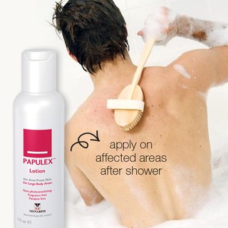Thuốc trị mụn lưng Papulex Lotion 125ml