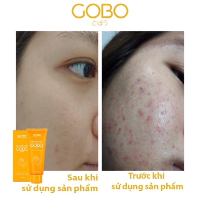 Sữa rửa mặt Gobo làm sạch sâu Cỏ Cây Hoa Lá 100g | BigBuy360 - bigbuy360.vn