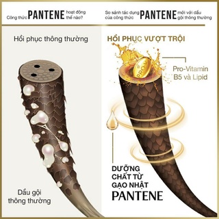 Dầu gội Pantene Sạch gàu 650ml
