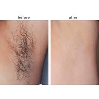 Hộp 10 miếng wax lông