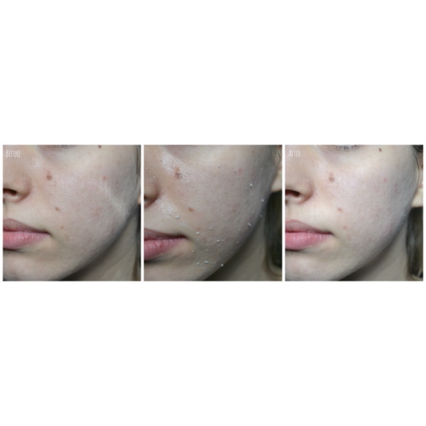 Tẩy Da Chết ROSETTE PEELING GEL - tẩy tế bào chết rosette Nhật Bản 120g