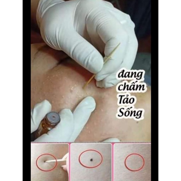 Tảo sống chấm nám tàn nhang 1ml.