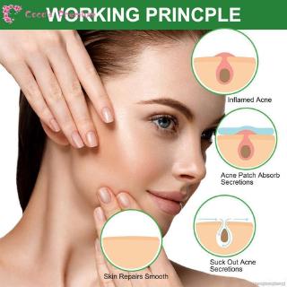 ELAIMEI Coco Tea Tree Acne Patch Hydrocolloid Waterproof Clear Pimple Patch Acne Treatment Patch
