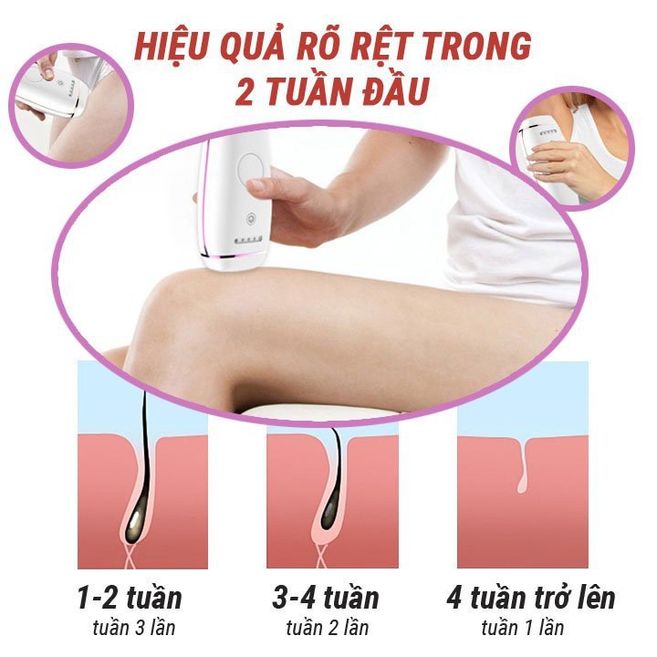 Máy Triệt Lông Vĩnh Viễn Mini IPL Cầm Tay Xung 990000 Sử Dụng Công Nghệ Cao Kết Hợp Với Trẻ Hóa Làn Da Hàng Chính Hãng