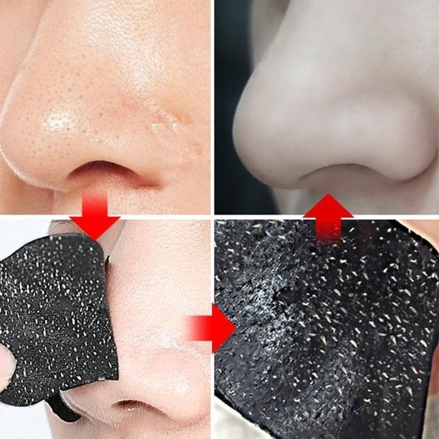 1 Mặt Nạ Lột Mụn Đầu Đen Làm Sạch Sâu Chăm Sóc Da