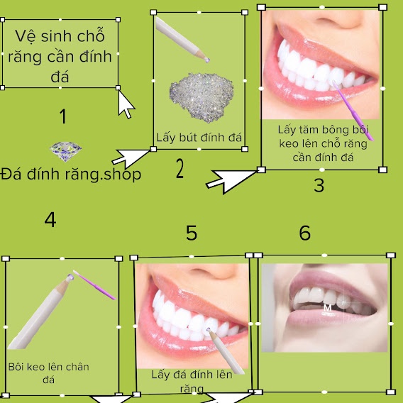 Keo đính đá răng gel gắn đá răng 2ml siêu chắc