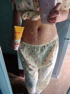 Kem Tan Mỡ Gừng Ớt
