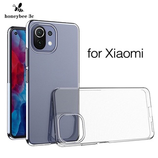 Ốp điện thoại tpu mềm trong suốt NFC cho Xiaomi Mi 13 Ultra 12T 12 12X 11 Lite 5G NE 11T 10T Poco F5 X5 M5s M5 C40 F4 X4 F3 X3 GT NFC M4 M3 Pro